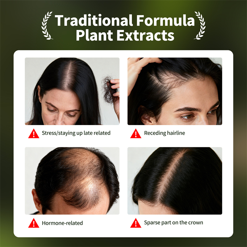 Natural Hair Growth Set Usman  - Hair Care Natural Products ulasan dan harga