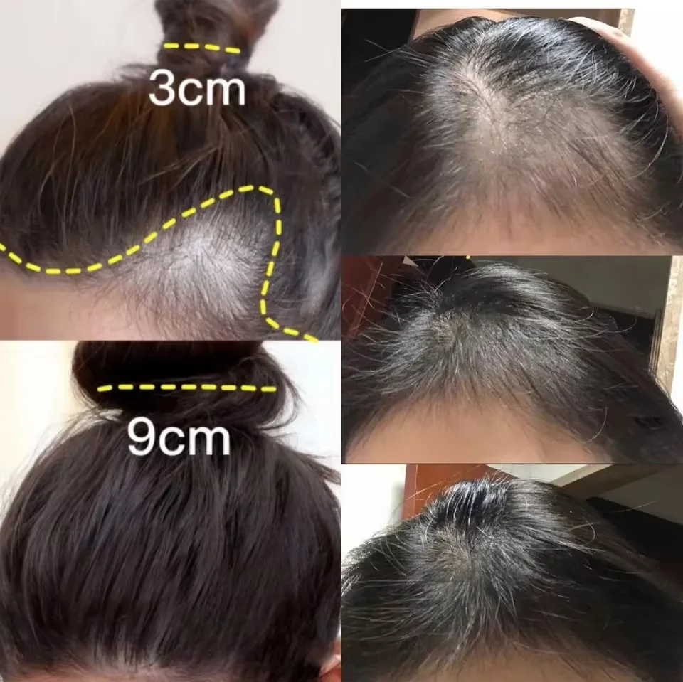 Fast Ginger Hair Growth Cream  - Hair Care Dupes ulasan dan harga